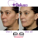 Micro Lift | Massageador Facial Microcorrente Lifting Do Rosto